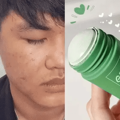 PoreClean Limpieza profunda para poros y puntos negros