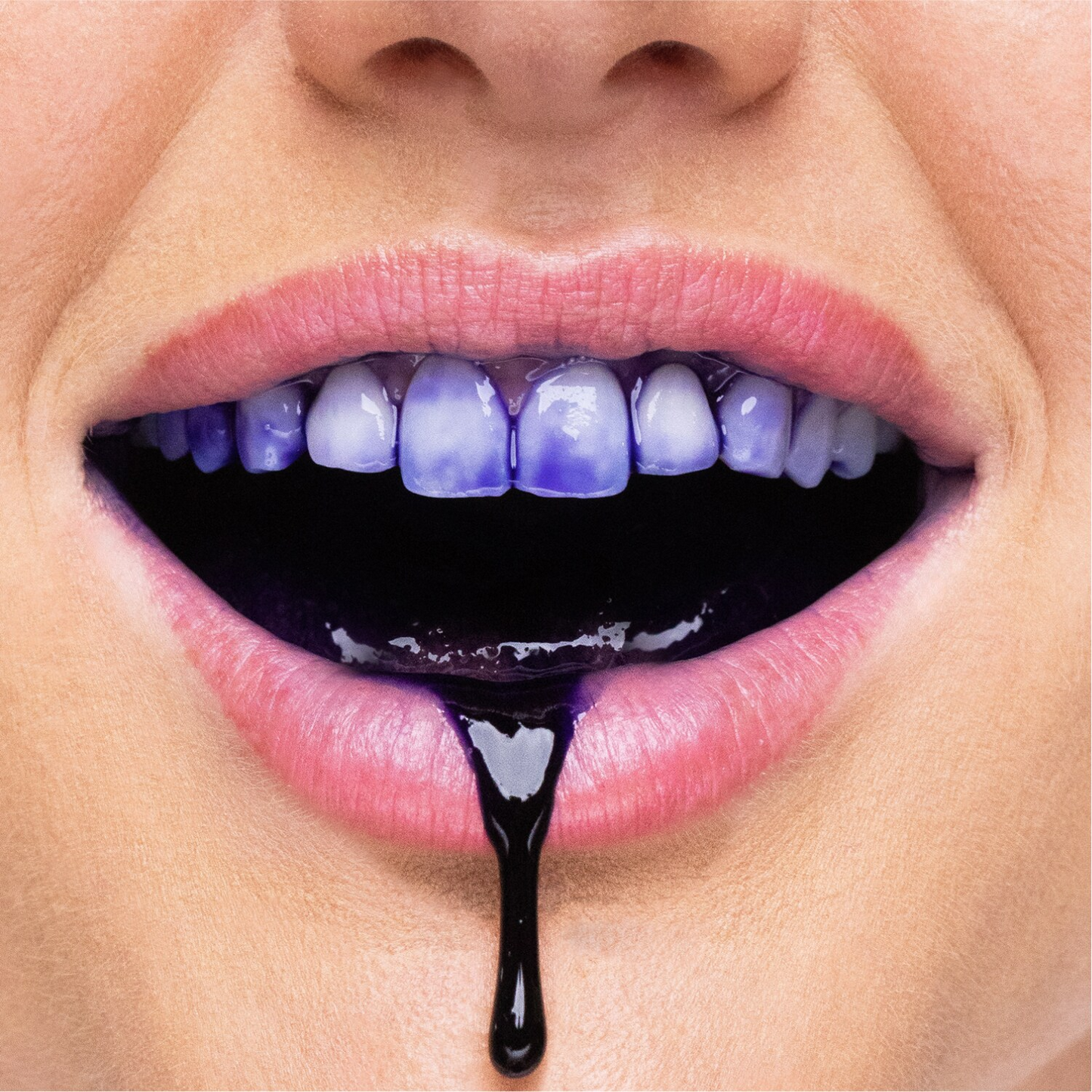 HiSmile™ V34 - Crema blanqueadora para dientes sensibles PROMO